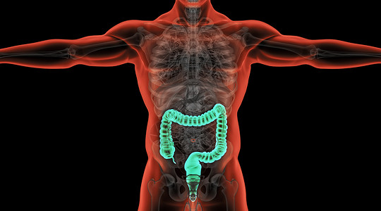 结肠息肉X光人体结肠场景设计图片