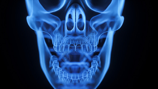 牙齿X光3D下颚骨场景设计图片