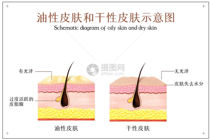 油性皮肤和干性皮肤示意图图片