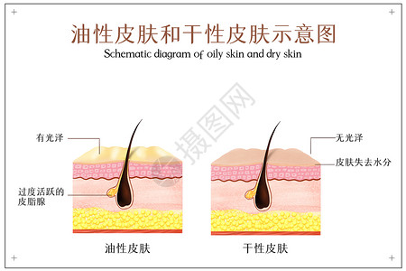 油性皮肤和干性皮肤示意图背景图片