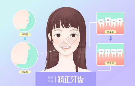 医疗美容矫正牙齿图片