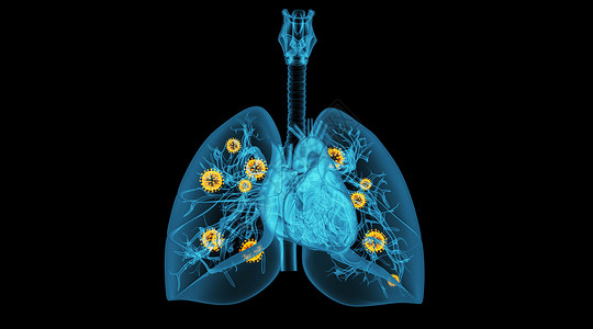 肺部病变场景高清图片