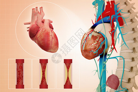 心脏疾病图片
