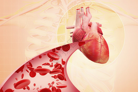 心脏疾病血栓堵塞的高清图片