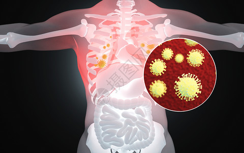 人体肺部病毒病变背景图片