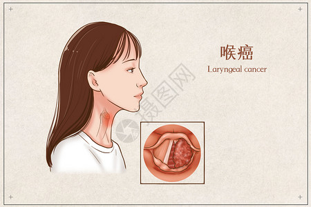 摸喉咙喉癌医疗插画插画