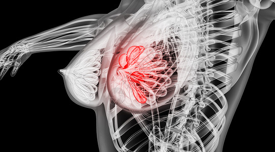 乳房结构人体乳腺病变场景设计图片