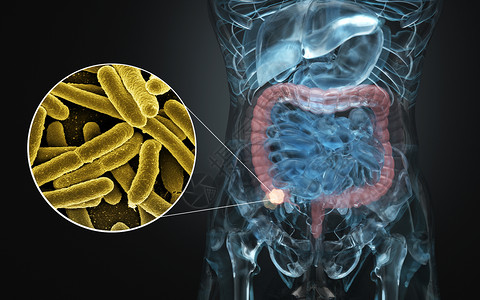 透明人体素材人体肠道疾病设计图片