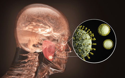 人体腮腺感染背景图片