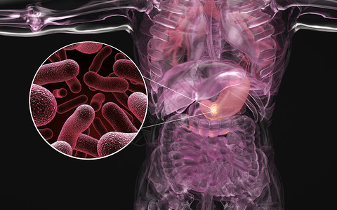 胃炎人体胃部疾病场景设计图片