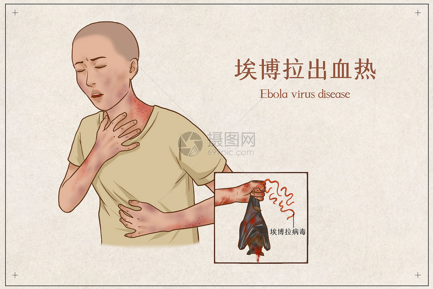 埃博拉出血热医疗插画图片
