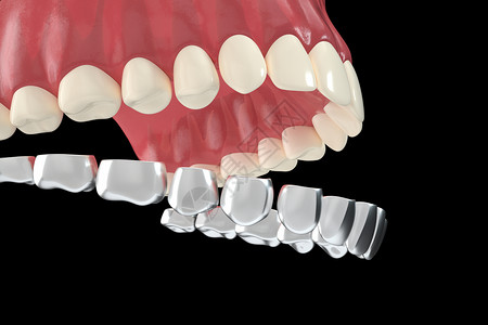 美白修复C4D牙齿矫正场景设计图片