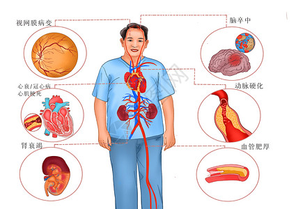 高血压主要危害医疗插画背景图片