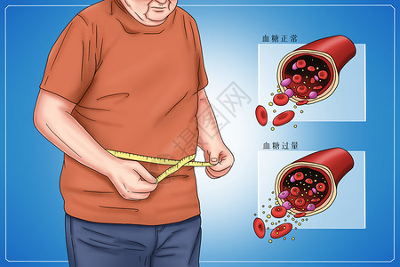 测量卷尺糖尿病类型2型糖尿病医疗插画插画