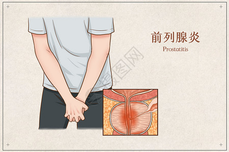 手掐腰的人前列腺炎医疗插画插画