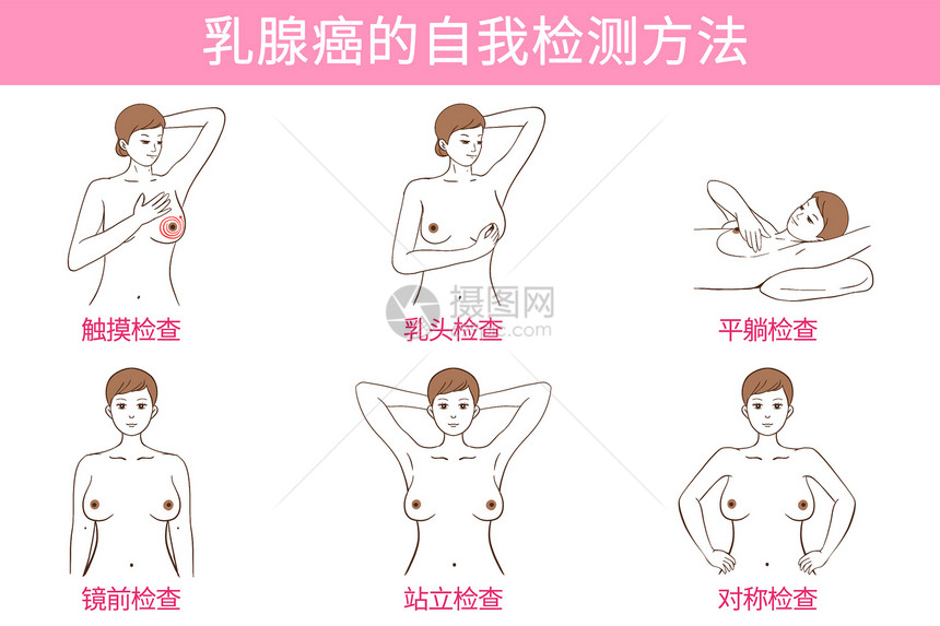 乳腺癌自检方法医疗插画图片