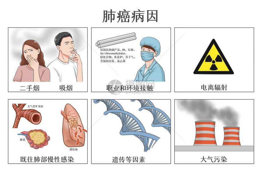 肺癌病因医疗插画图片