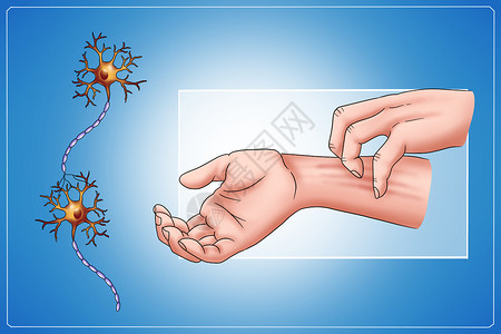 油腻皮肤糖尿病症状皮肤瘙痒医疗插画插画