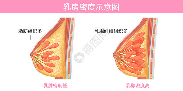 乳腺结构乳腺密度示意图医疗插画插画