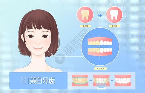 口腔图标美白牙齿医疗插画插画