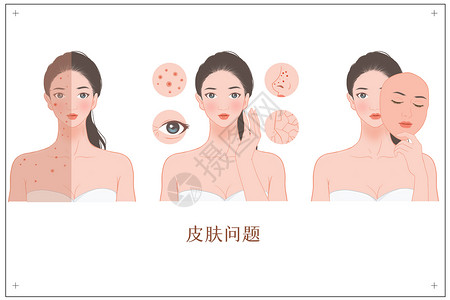 中药护肤女性各种皮肤问题插画