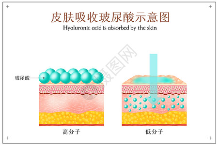 高分子皮肤吸收玻尿酸示意图插画