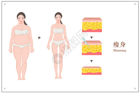 女性抽指瘦身对比图医美插图背景图片