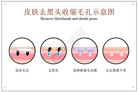 去黑头收缩毛孔皮肤护理示意图高清图片