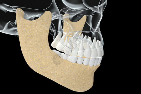 下颌骨医美牙齿矫正设计图片