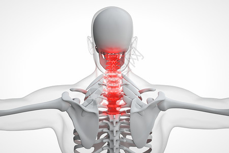 诊断病症C4D人体颈椎骨骼设计图片