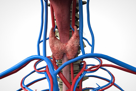 甲状腺肿块人体模型肿块高清图片