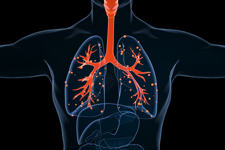 人体器官透视肺部病变场景设计图片