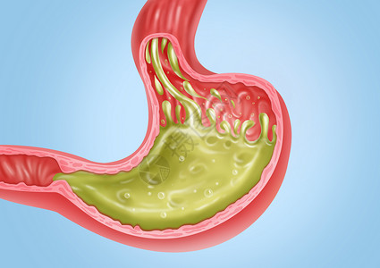 器官结构胃反流医疗健康插图插画