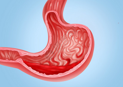 胃出血医疗健康插图高清图片