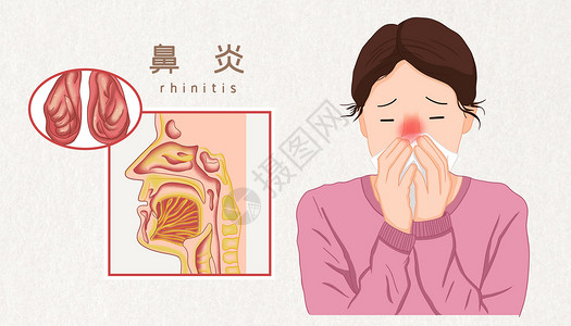 鼻炎医疗插图图片