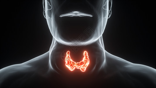 甲状腺彩超C4D甲亢场景设计图片