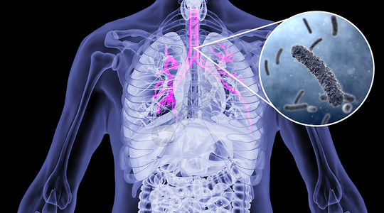 支气管肺炎人体支气管炎场景设计图片