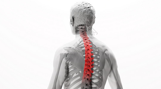 人体脊椎病场景图片