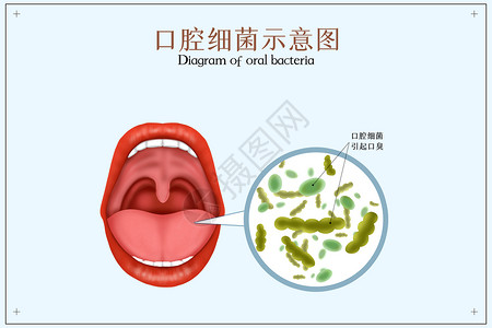 舔舌头细菌引发口臭口腔医学配图插画