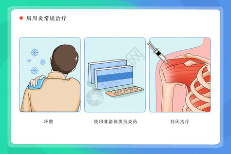 高职专科肩周炎常规治疗医疗插画插画