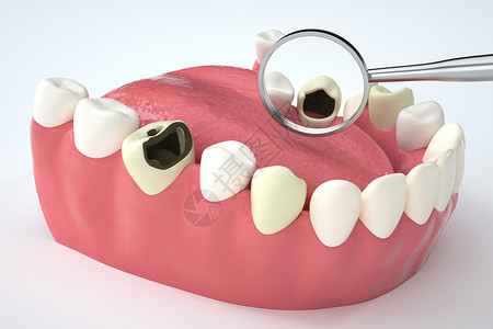 C4D牙齿C4D龋齿场景设计图片