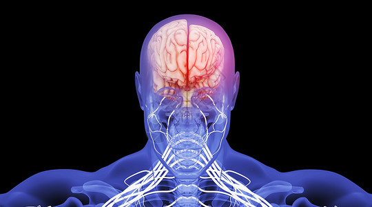 脑萎缩场景人体结构左右脑高清图片