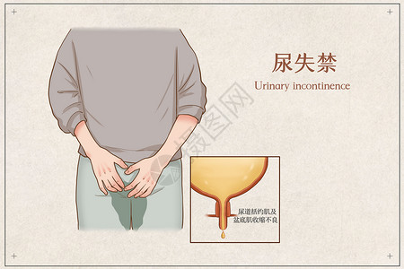 尿失禁医疗插画人体高清图片素材
