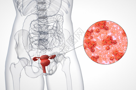 阴道炎症膀胱细菌场景设计图片