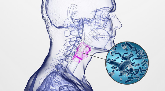 人体咽喉炎场景高清图片