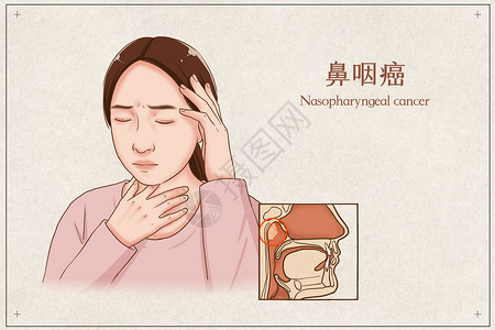 鼻咽癌医疗插画背景图片