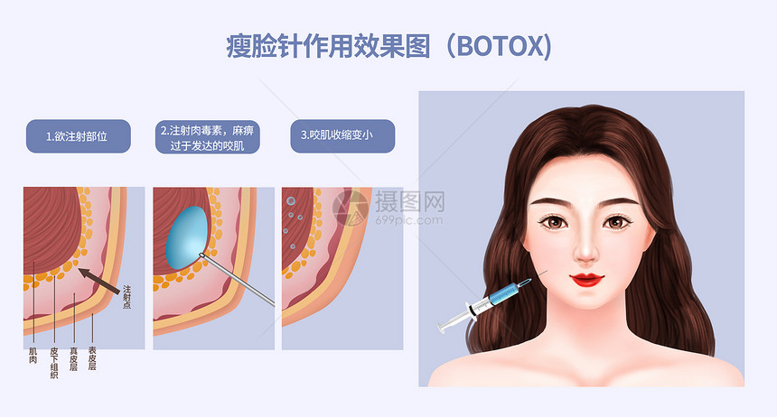 瘦脸针作用效果图图片