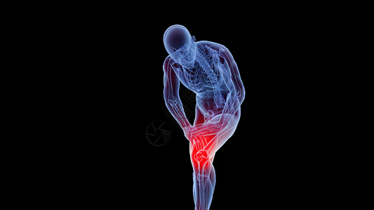 活动受限C4D膝关节疼痛场景设计图片
