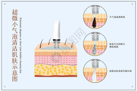 毛孔清洁超微小气泡护理肌肤医美配图插画