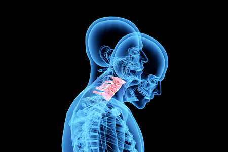 C4D颈椎病背景设计图片